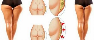 Как убрать ушки на бедрах: пошаговая инструкция