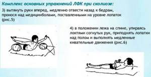 ЛФК гимнастика для спины и позвоночника при сколиозе, грыже, остеохондрозе